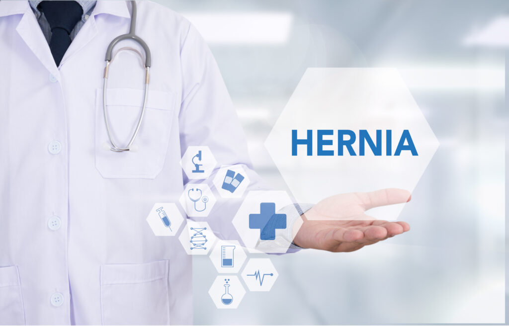 doctor with medical report on hernias