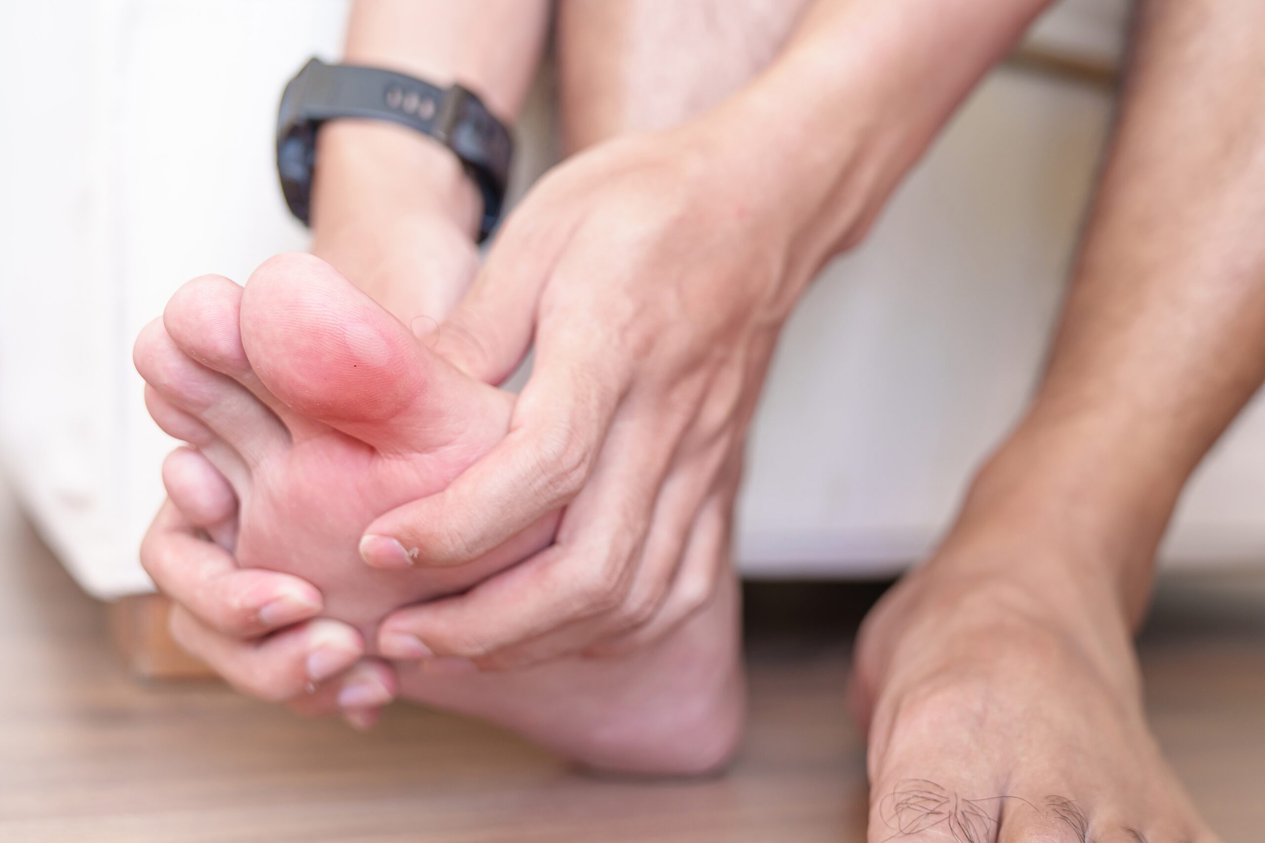 Expert Tips on Dealing with Bunions
