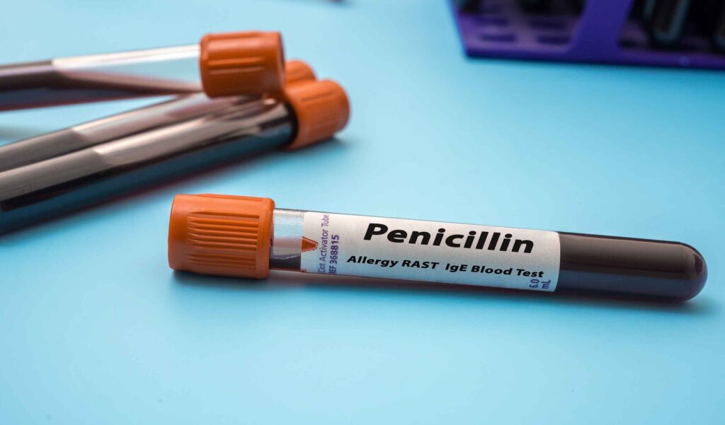 A blood sample vial labeled "Penicillin Allergy RAST IgE Blood Test" with an orange cap lies on a blue surface, accompanied by two similar vials in the background.