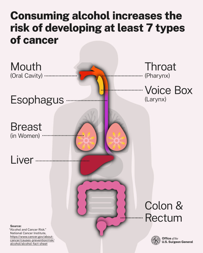 Purpose of image is to display the relationship between alcohol and cancer. Illustration showing the human body with highlighted areas where alcohol increases cancer risk: mouth, throat, voice box, esophagus, breast (in women), liver, and colon & rectum. Includes a source note from the U.S. Surgeon General's office.