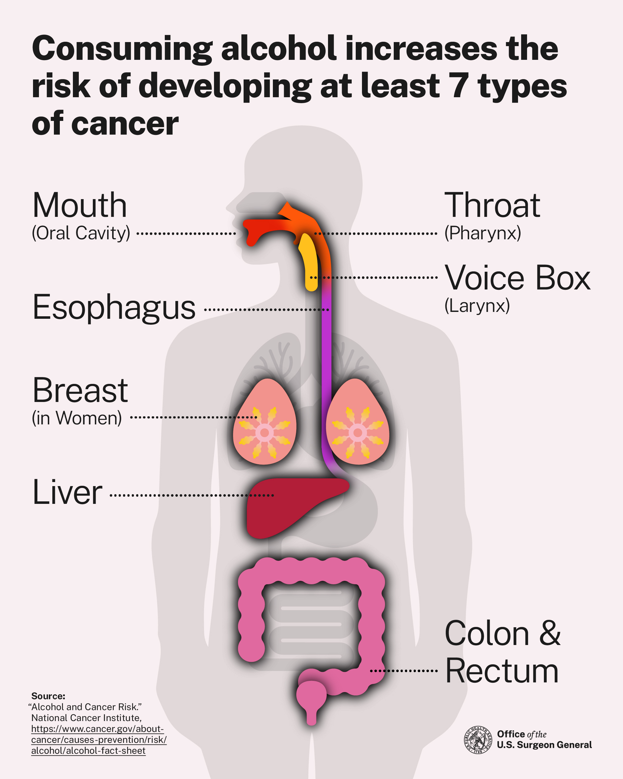 Alcohol and Cancer: A Growing Concern for Rural Iowa